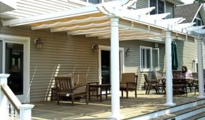 Retractable Canopy Multi Track
